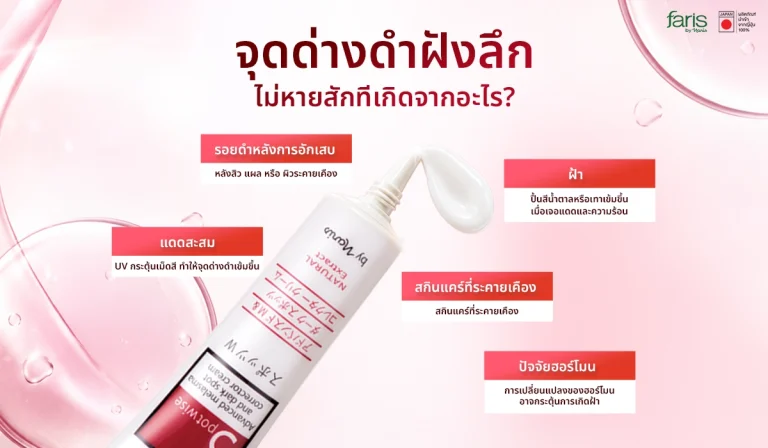 สาเหตุของ จุดด่างดำฝังลึก และฝ้าแดดสะสม พร้อมวิธีดูแลผิวให้กลับมากระจ่างใส