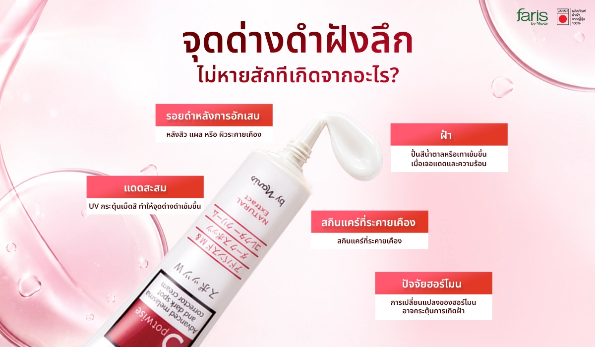 สาเหตุของ จุดด่างดำฝังลึก และฝ้าแดดสะสม พร้อมวิธีดูแลผิวให้กลับมากระจ่างใส